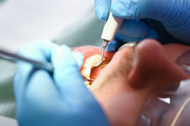 Best Emergency Denture Repair in Rock Island, IL