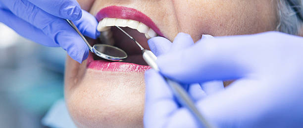 Best Emergency Wisdom Tooth Extraction in Rock Island, IL